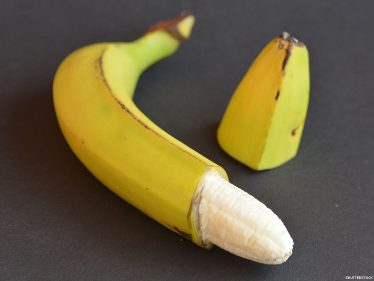 does-male-circumcision-shield-women-from-hiv-750