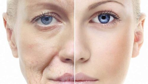 anti-aging-treatment-lead_730x419